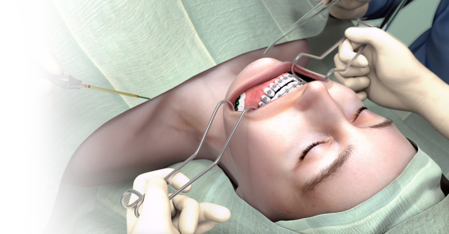 photorealistic renderings of a surgery