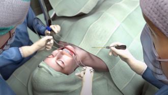 Thumbnail Video - surgery mandible